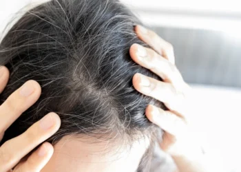 Rahsia Awet Muda: Tips Elak Rambut Beruban Seawal 30an