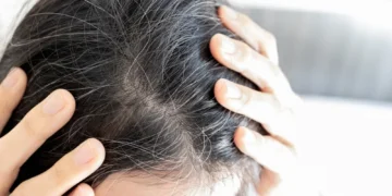 Rahsia Awet Muda: Tips Elak Rambut Beruban Seawal 30an