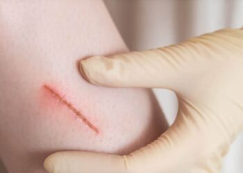 Cara Bersihkan Luka Jahitan dengan Betul: Elak Jangkitan & Parut