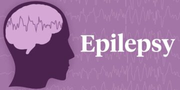 Causes and Symptoms of Epilepsy