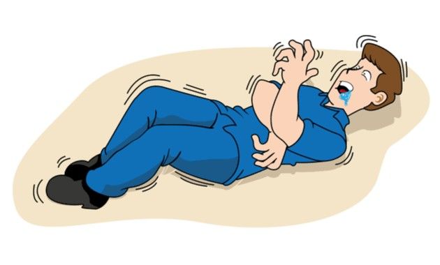 Symptoms of Epilepsy