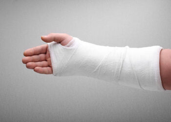 Cast Tangan: Cara Menjaga Kebersihan & Elak Jangkitan Kulit