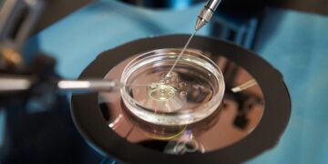 What Is IVF Treatment and What To Expect