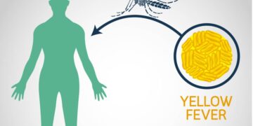 Yellow Fever: Symptoms and Prevention