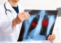 What Is Pneumonia?