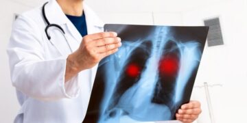 What Is Pneumonia?