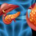 Symptoms of Pancreatic Cancer