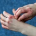 What Is Eczema?