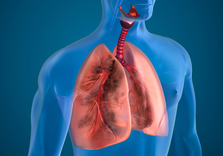 Effects Of Vaping