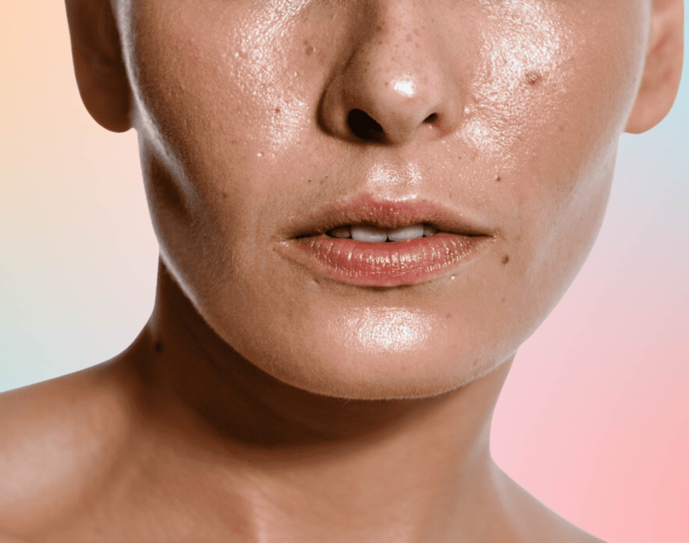 Kulit Muka Berminyak