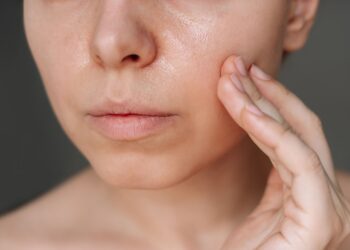 Kulit Muka Berminyak: Hormon Atau Cara Cuci Salah?