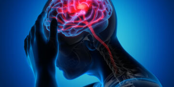 Jangan Ambil Ringan! Ini Simptom Awal Stroke Yang Ramai Tak Sedar