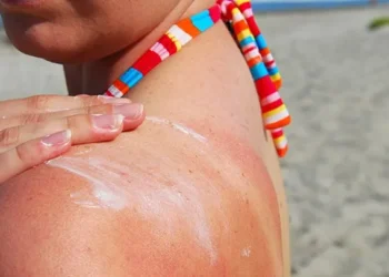 Kenapa Kulit Naik Ruam & Gatal Selepas Mandi Laut? Ini Puncanya & Cara Atasi