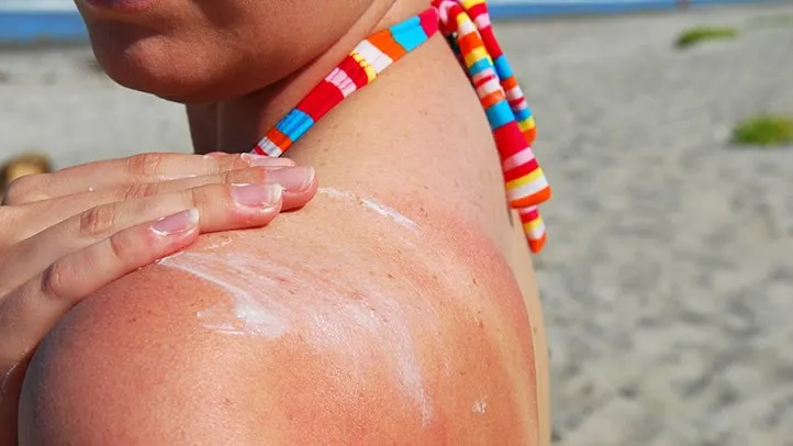 Kenapa Kulit Naik Ruam & Gatal Selepas Mandi Laut? Ini Puncanya & Cara Atasi