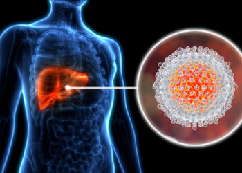 Apa Itu Hepatitis B dan Cara Pencegahannya