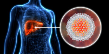 Apa Itu Hepatitis B dan Cara Pencegahannya