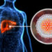 Apa Itu Hepatitis B dan Cara Pencegahannya