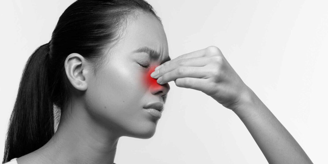 Sinusitis: Kenapa Hidung Sentiasa Tersumbat?