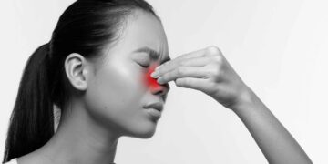 Sinusitis: Kenapa Hidung Sentiasa Tersumbat?