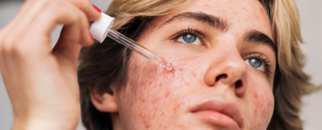 retinol