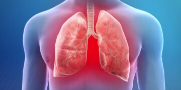 Pneumonia: Bagaimana Jangkitan Paru-Paru Boleh Menjadi Serius?